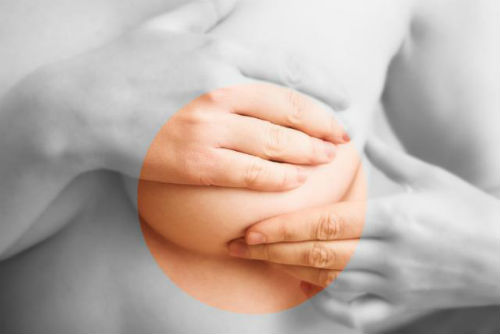 semne premonitorii pentru afectiunile mamare: Boala Paget, mastoza fibrochistica, scurgri mamelonare, cancer mamar